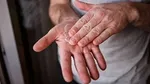 A person rubbing cream into their hands